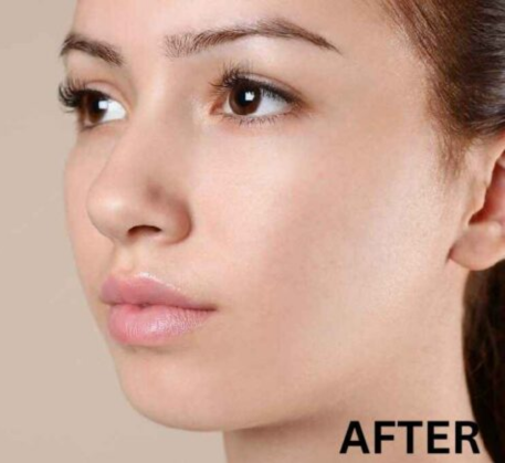 1747367970_medi-facial-after.png