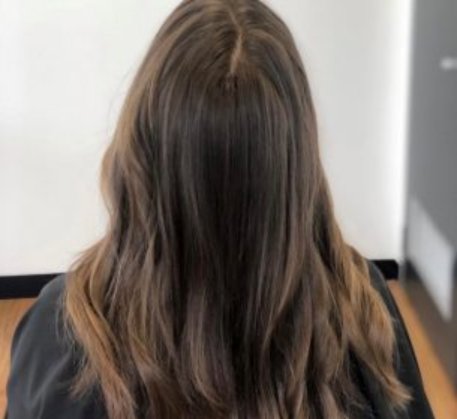 1749620956_hair-loss-treatment-after.png