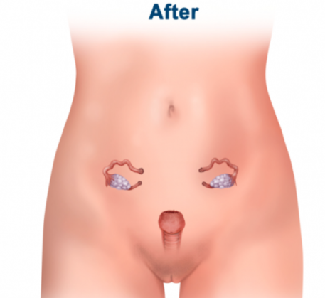1749812523_vaginal-tightening-treatment-after.png