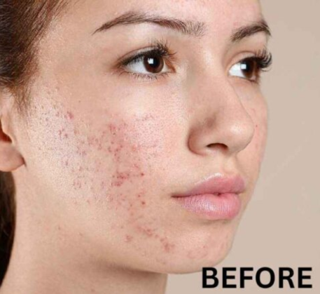 1747367970_medi-facial-before.png