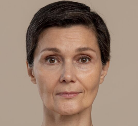 1747368129_rf-skin-tightening-facial-before.png