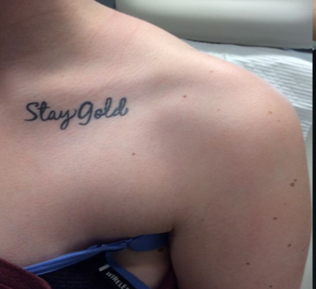 1749621230_tattoo-removal-treatment-before.png