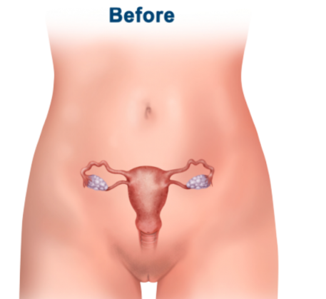 1749812523_vaginal-tightneing-treatment-before.png