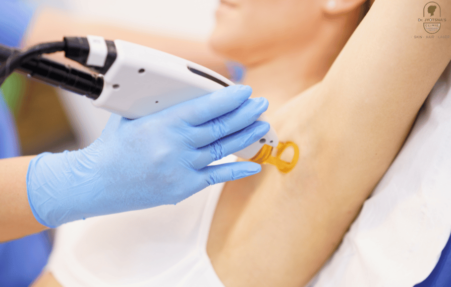 1720432447_laser-hair-removal-treatment-in-thane.png