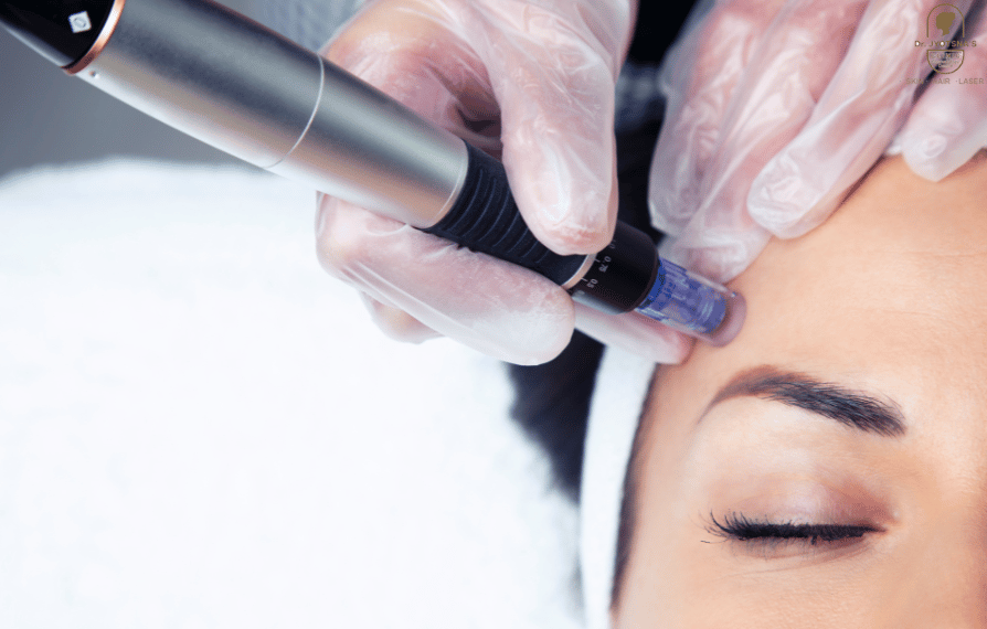 1720433038_micro-needling-treatment-in-thane.png