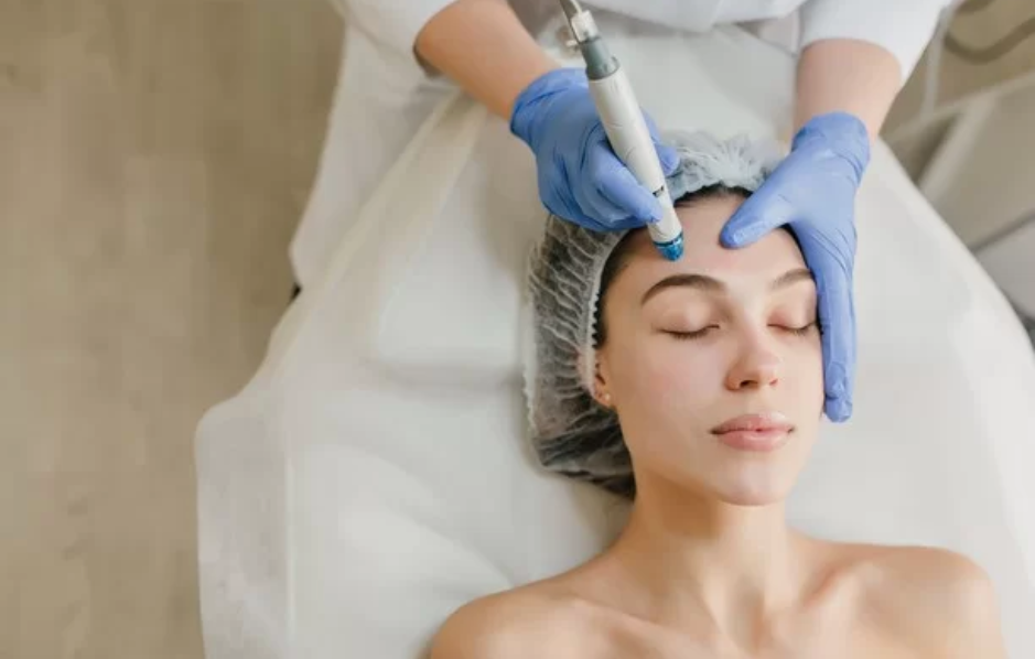 1747368870_big-img-acne-scar-treatment.png