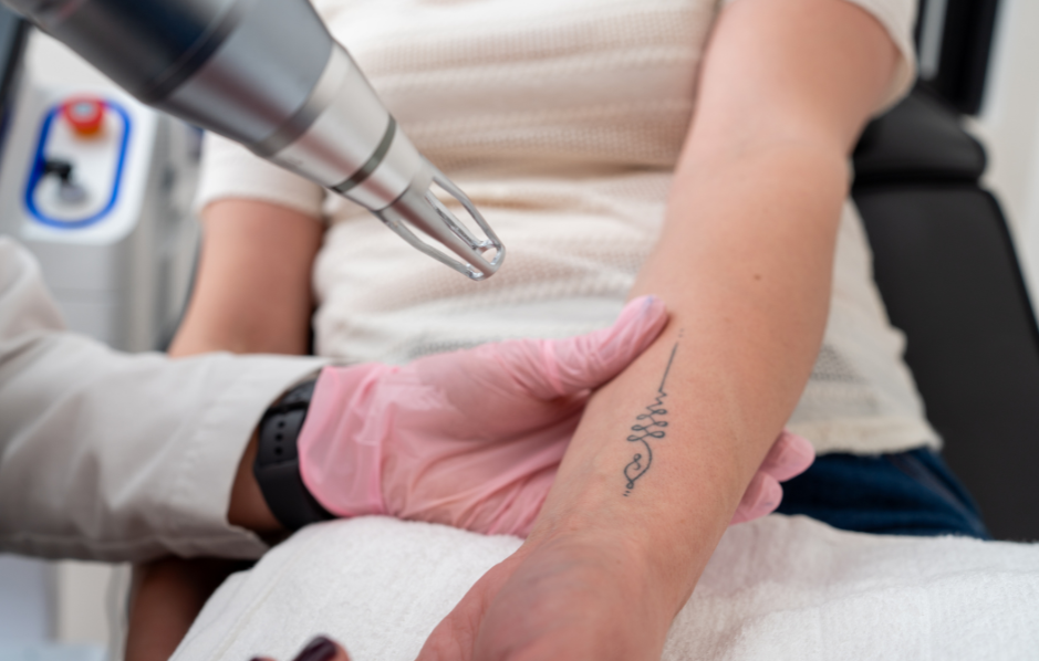 1749621230_big-image-tattoo-removal-treatment.png